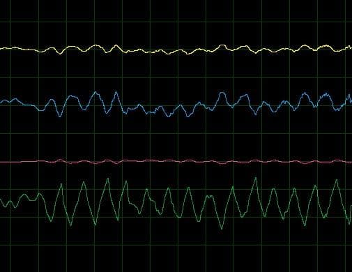 Analog Portable Audio Amplifier - Image 4